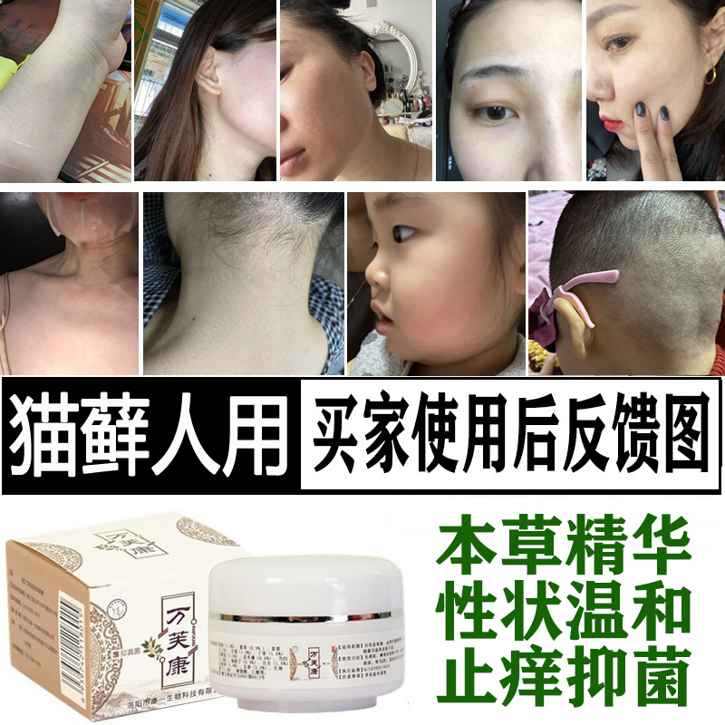 猫藓人用药猫癣专用外用感染人得真菌皮肤病消炎止痒中药抑菌药膏