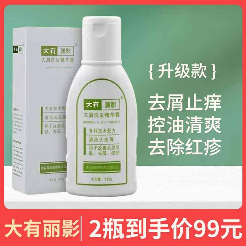 大有丽影去屑洗发水精华露控油止痒清爽去除红疹大块头皮屑洗发露