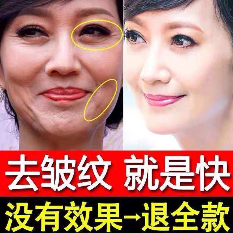 祛皱纹去除抬头纹男女提拉紧致六胜肽抗皱美白面霜抗衰老美白神器