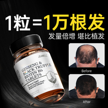 维生素b6防脱发生发生物素hb7复合b族片掉头发严重吃什么叶酸正品