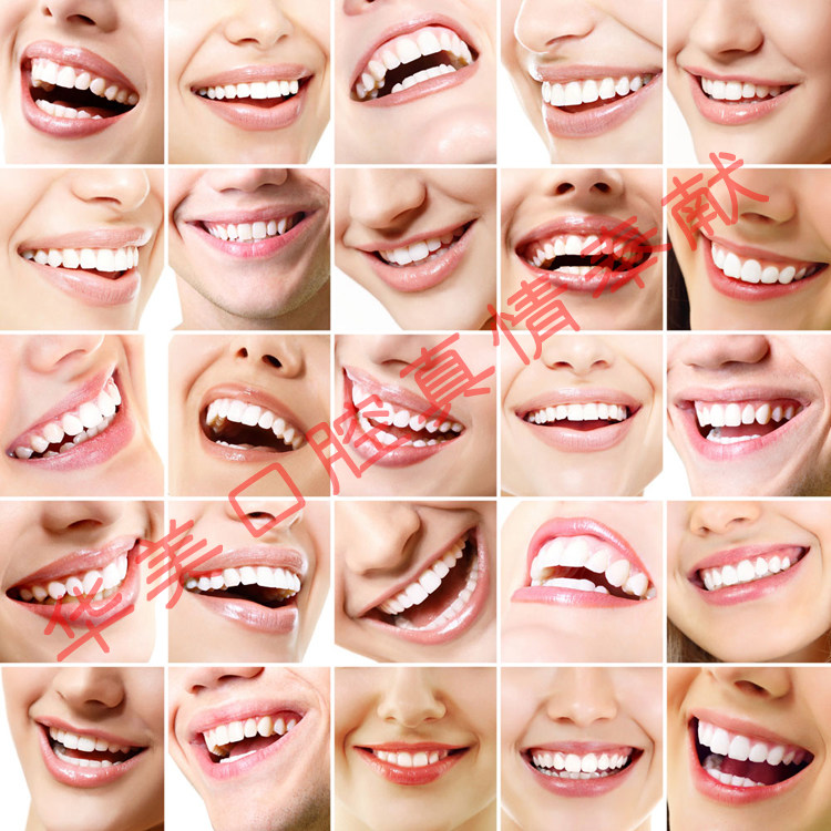 牙科材料牙釉质冰瓷全瓷齿雕pa17钻石白超白亮白纳米材料