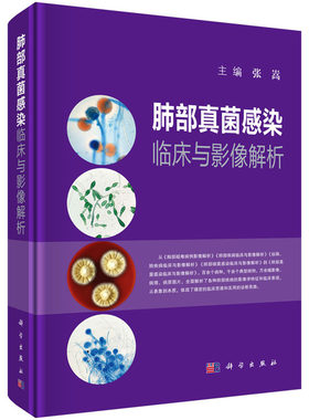 肺部真菌感染临床与影像解析 张嵩主编 肺部几大类真菌感染的临床表现和影像学特点丛书 疾病为本 科学出版社