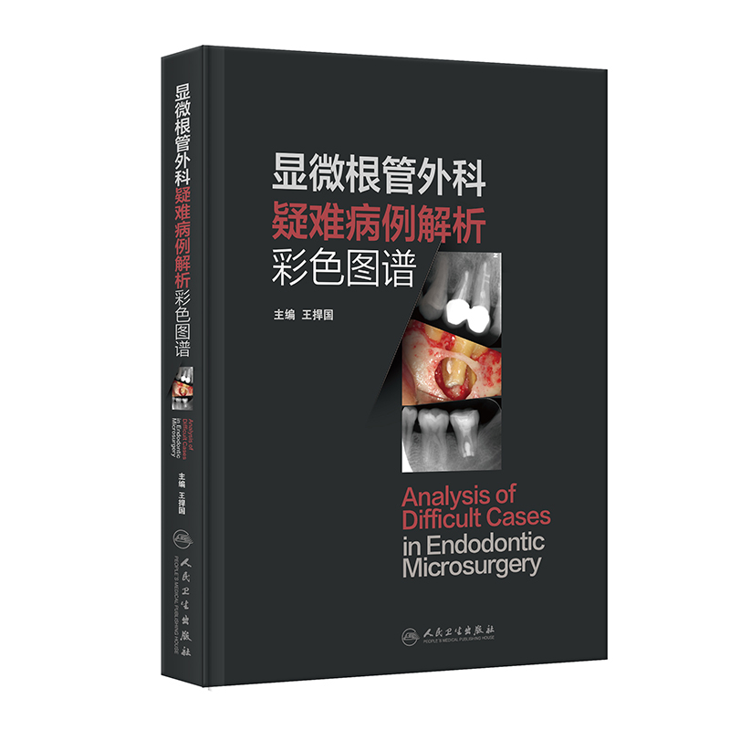 显微根管外科疑难病例解析彩色图谱王捍国口腔科学人民卫生出版社凤凰新华书店旗舰店