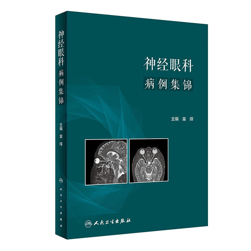 神经眼科病例集锦 童绎 主编 眼球运动异常和相关斜视 神经眼科疾病 两条及以上脑神经麻痹等 人民卫生出版社 新华正版书籍