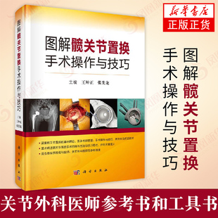 图解髋关节置换手术操作与技巧 王坤正张先龙 科学出版社 解析解读 图文并茂骨科医学卫生 外科学类书籍【凤凰新华书店旗舰店】