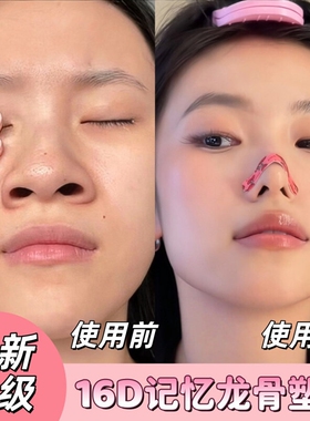 升级记忆龙骨可调塑翘鼻贴