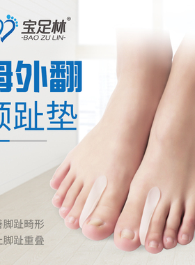 拇外翻分趾垫脚趾套宝足林脚趾