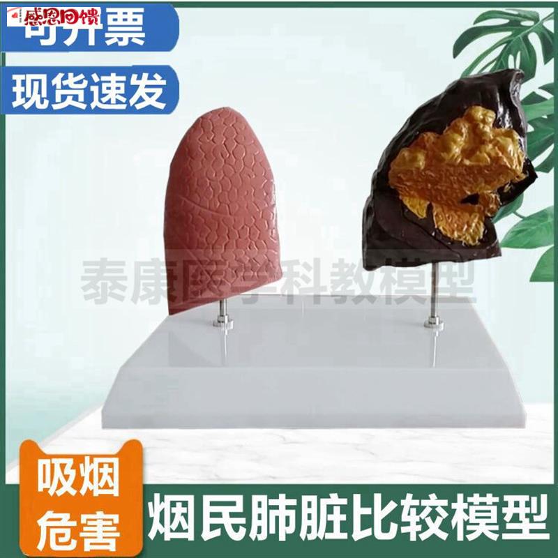 爱国卫生运动教育模型禁烟警d示展示吸烟有害健康模型危害人体器