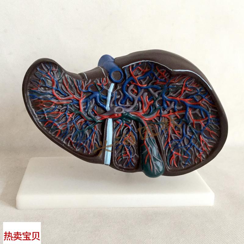 肝解剖模型