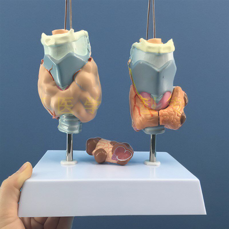 甲状腺病变d 甲状腺病理模型 甲亢甲低甲减 人体内分泌系统模型