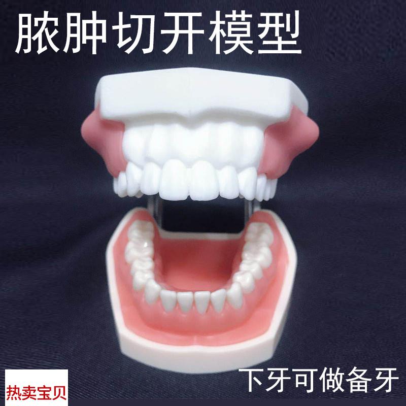 脓肿切开模型口腔执业医师考前培训引流牙模牙P科教学牙齿肿块可