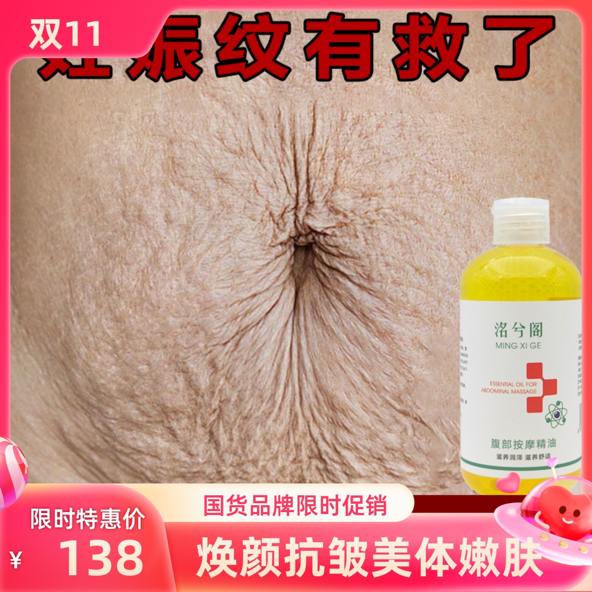 妊娠纹按摩精油产后修复消除祛除护理紧致淡化妊娠胖纹孕妇产后用