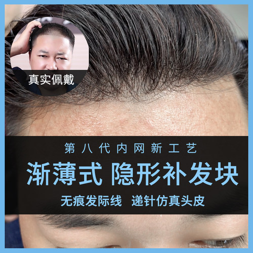 俏美真人发丝渐薄式发际线递针顶