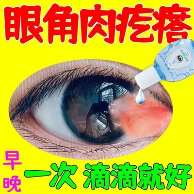 去除眼睛胬肉滴眼液眼睛长胬肉有异物感模糊看不清翼状胬肉眼药水