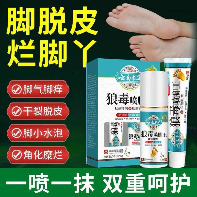 脚气根去专用特效止痒脱皮杀菌烂脚丫糜烂脚趾缝烂止痒膏药除臭