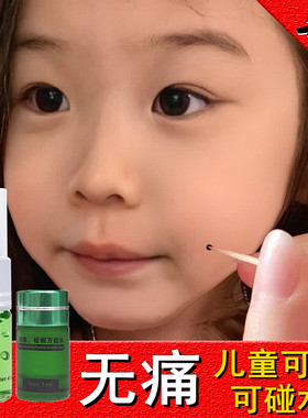 新款点痣去痣斑点脸部神器痦子去除家用痣美容院正品无痕黑点