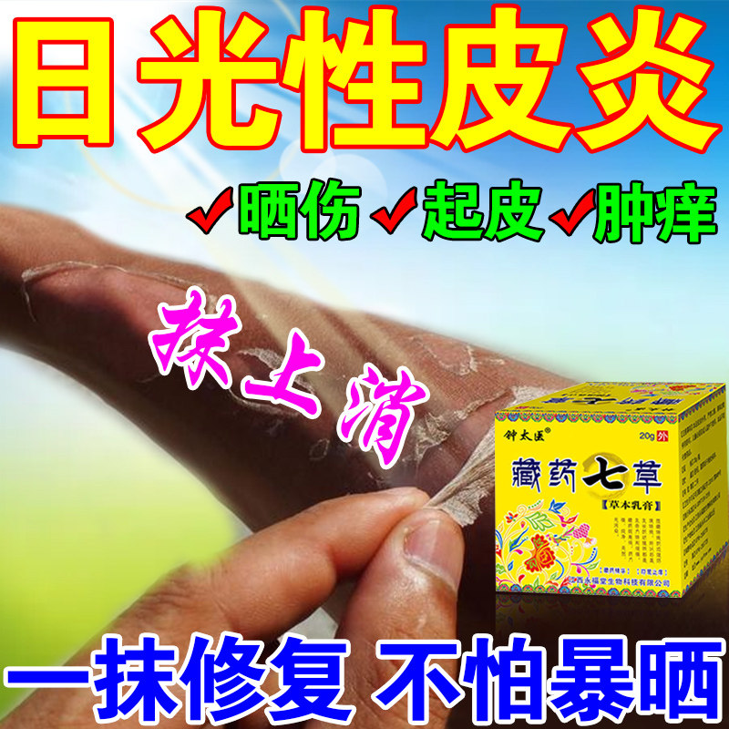 日光性皮炎防紫外线抗过敏太阳晒伤皮肤晒伤药治疗日光性皮软膏