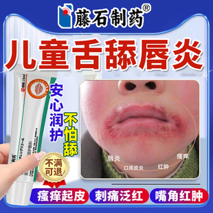 儿童舌舔唇炎唇膏防舔嘴唇干裂脱皮医用口角炎烂嘴角专用膏药贴YU