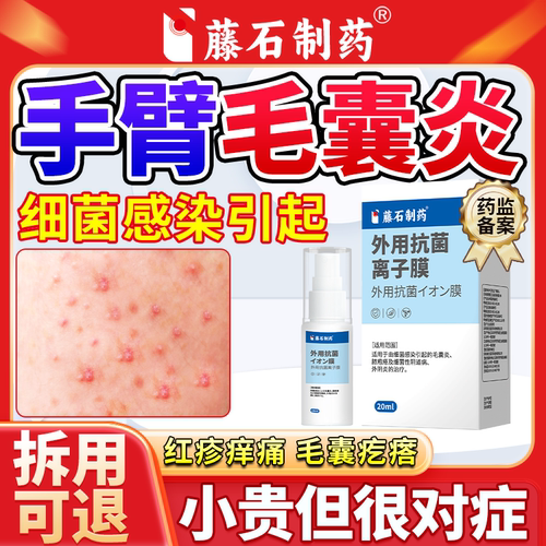 手臂毛囊炎胳膊上长疙瘩鸡皮肤角化去藤石制药除感染搭专用药膏ON