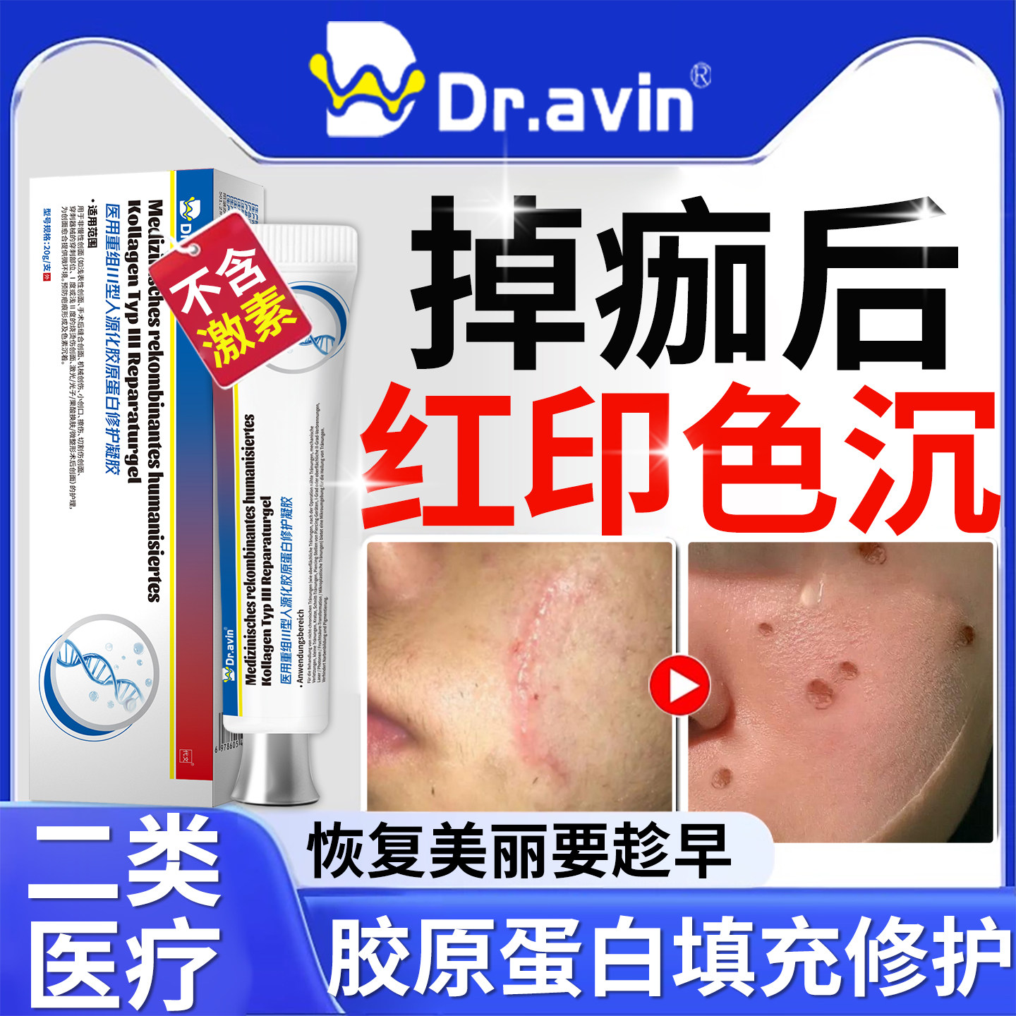 掉痂后红印疤痕修复摔伤擦伤祛疤膏淡化点痣红印黑印色素沉淀去YU图片