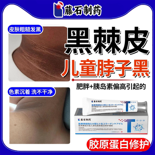 藤石制药儿童去脖子黑棘皮膏医用型除黑色素沉淀洗不干净美白霜ON