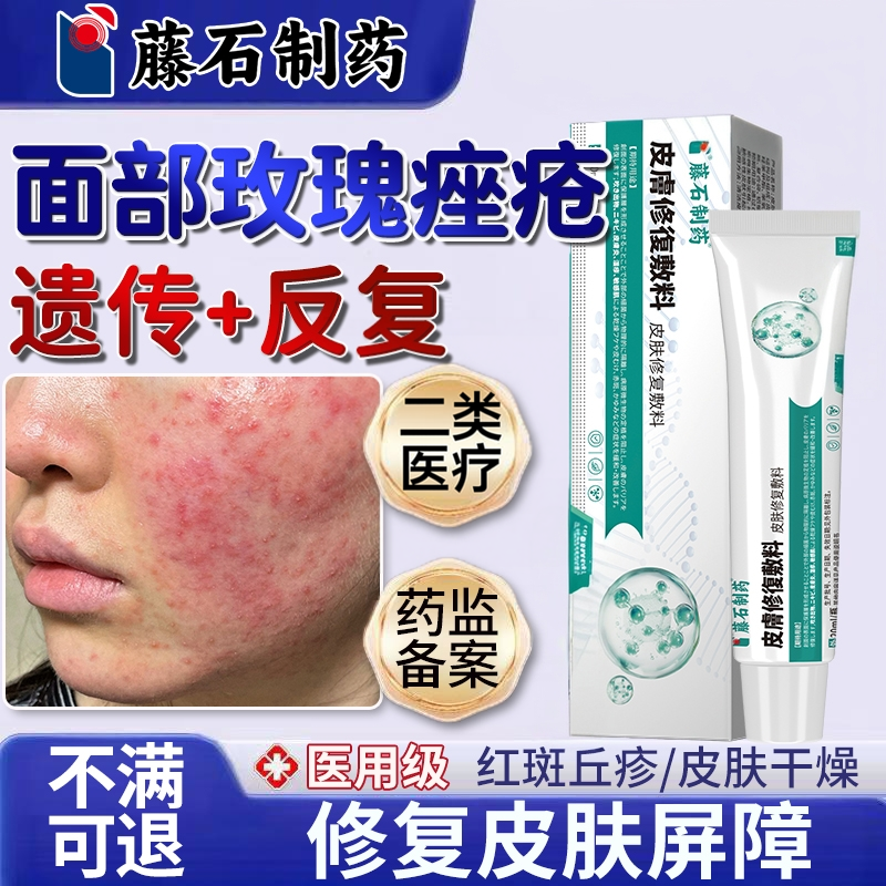 玫瑰痤疮修复屏障敏感肌消软膏炎脂溢性皮炎酒糟鼻搭洗面奶面膜YU