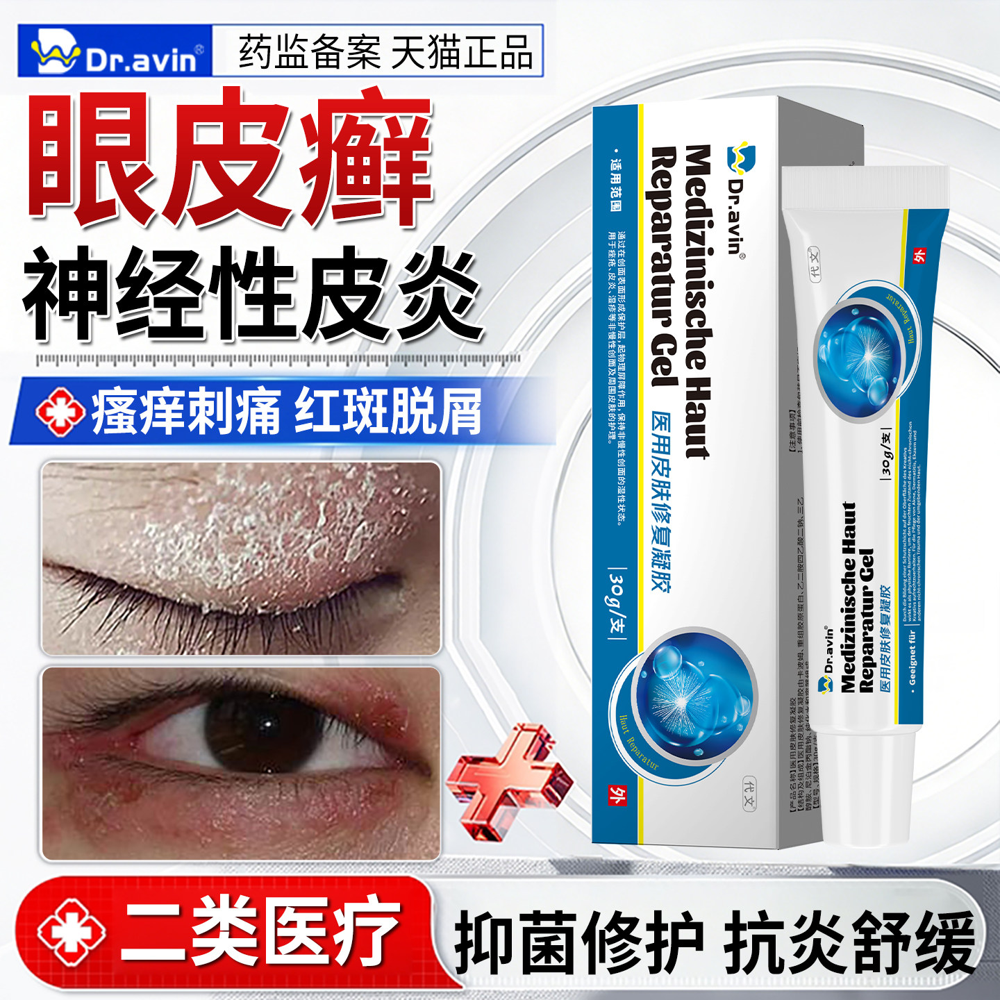眼皮神经性皮炎专外用皮肤病癣顽固藓湿疹真菌感染特起皮止痒效ON - 实物图