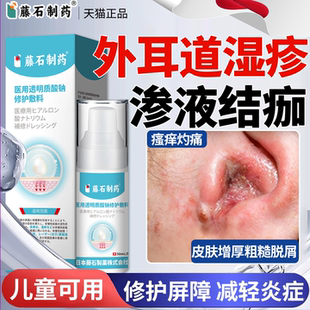 外耳道炎湿疹耳朵痒真菌感染止痒去领专用和根真菌性药房同售膏ON