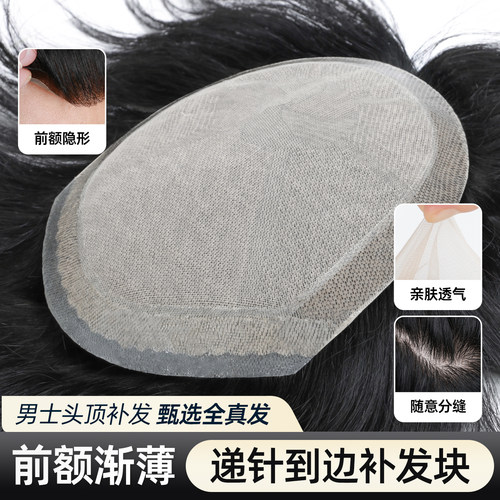 贝尔秀递针男士头顶补发块