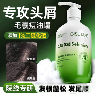 二硫化硒洗发液洗剂去屑洗头发水毛囊清洁止痒控油蓬松