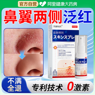 鼻翼两侧泛发红鼻子脂溢性皮炎修复面部脸上皮肤干燥脱皮起皮喷剂