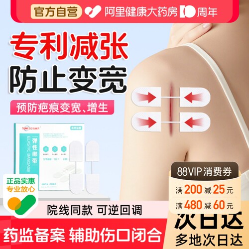 施美乐医用减张器拉链式减张贴伤口手术后疤痕免缝合