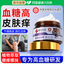 糖尿病皮肤瘙痒专用老年人止痒膏高血糖皮肤痒全身干燥起皮非特效