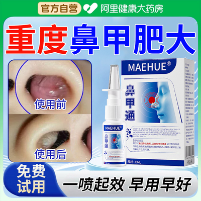 鼻甲肥大专用非鼻贴消肿药喷雾剂鼻炎鼻窦炎消炎修复鼻塞流鼻血