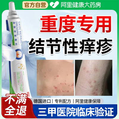 结节性痒疹治顽固硬疙瘩