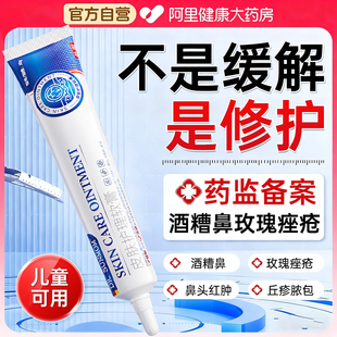 酒糟鼻专非用药膏玫瑰痤疮效药脸部下巴重度暗疮治疗痤疮的药膏