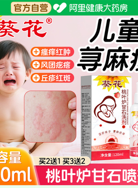 葵花儿童寻荨麻疹瘙痒过敏提高断止痒急慢性风团性根非药膏免疫力