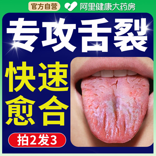 舌头裂痕地图舌齿痕舌调理灼口综合症裂纹有齿痕舌苔白厚治烂嘴药