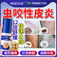 虫咬性皮炎毒虫蚊虫叮咬瘙痒快速止痒膏丘疹消肿过敏消炎药膏神器