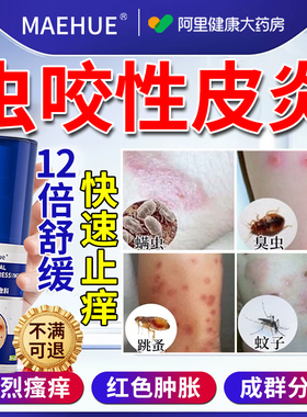 虫咬性皮炎毒虫蚊虫叮咬瘙痒快速止痒膏丘疹消肿过敏消炎药膏神器