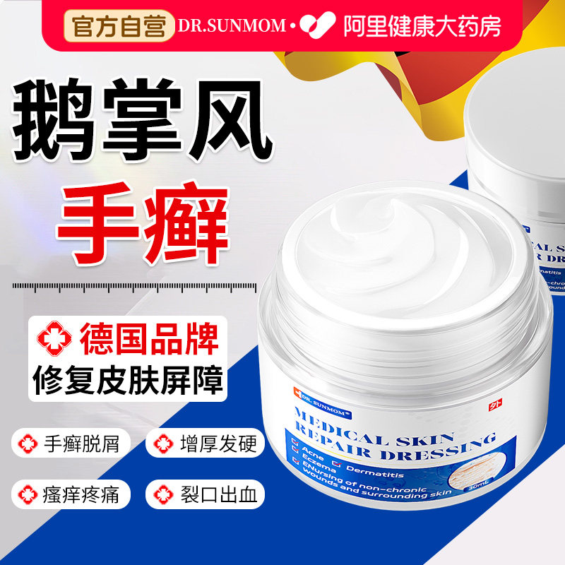 鹅掌风专用手癣膏药角化型湿疹手癣脱皮干裂痒增厚去足癣真菌感染