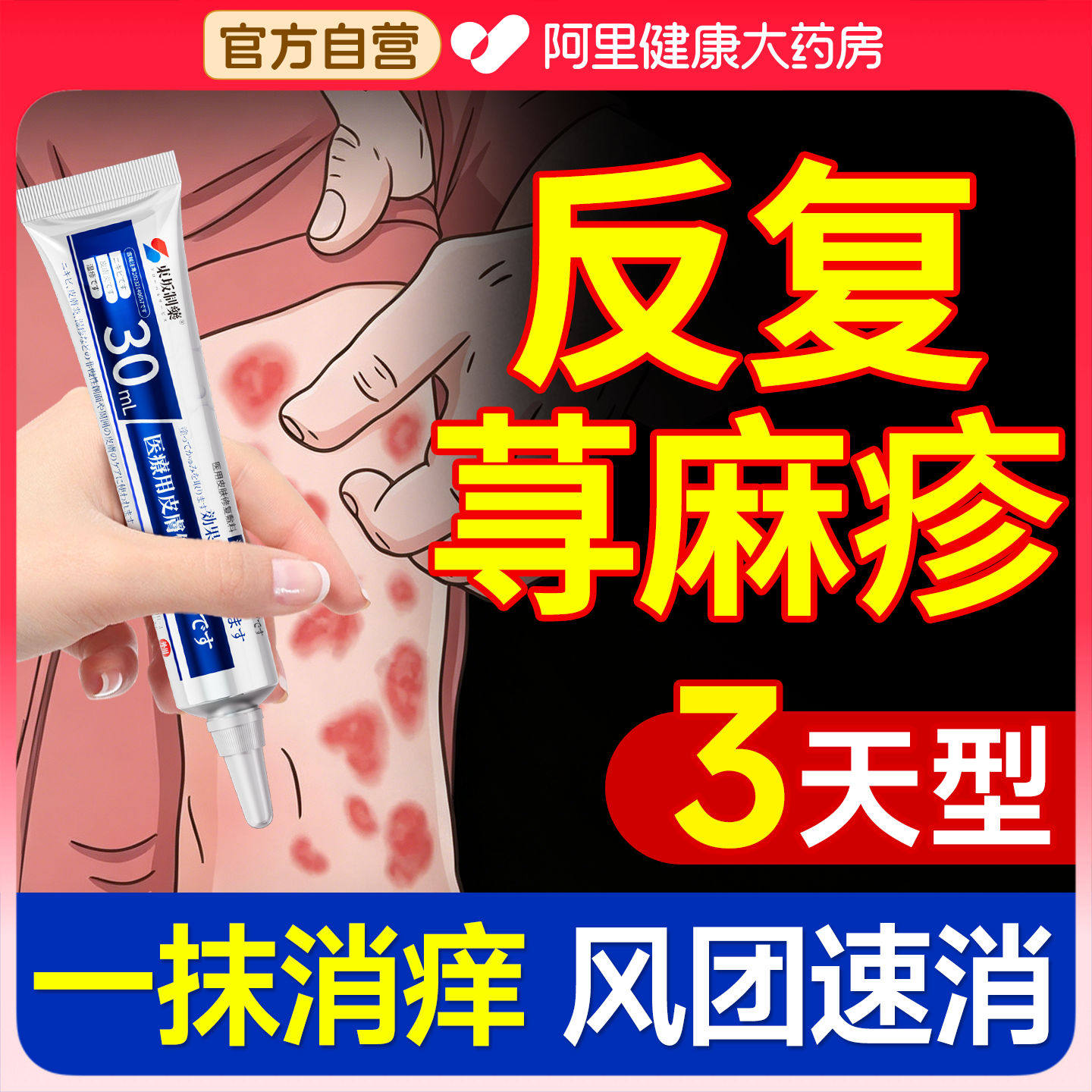 荨麻疹膏治过敏痒专用止疗丘疹胆碱急慢性免疫力特药房效提高