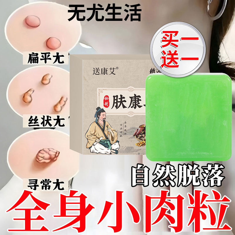 肤康皂祛去疣尤瘊猴肉粒专用香皂