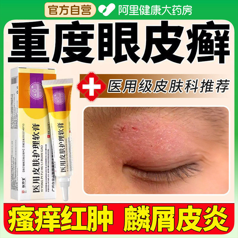 眼皮癣红肿眼睛周围痒过敏发痒眼膏止痒眼角里面干燥起神经性皮炎