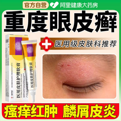 眼皮癣红肿眼睛周围痒过敏眼药膏