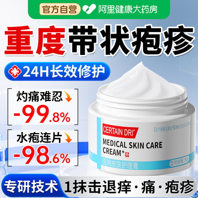 带状疱疹后遗症神经痛蛇盘疮止瘙痒痛治蛇缠断腰疱疹外专用正品膏