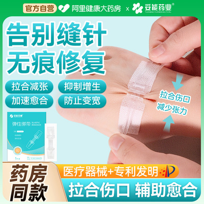 妥能医用拉链式减张器剖腹产甲状腺减张贴术后伤口愈合免缝疤痕贴