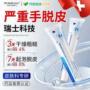 手脱皮干裂真菌感染起皮专用膏鹅掌风手痒起水泡季节性儿童手脱皮