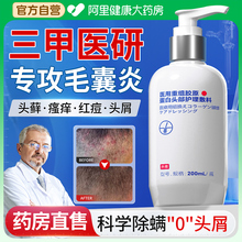 医用洗发水脂溢性皮炎洗发水二硫化硒毛囊炎去屑止痒抑菌头藓专用