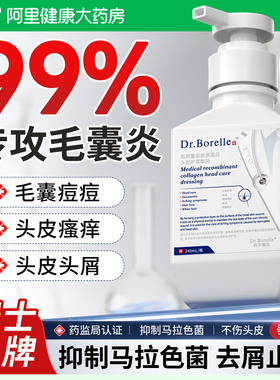 瑞士毛囊炎洗发水敷料马拉色菌去屑脂溢性皮炎止痒头皮非药膏特效